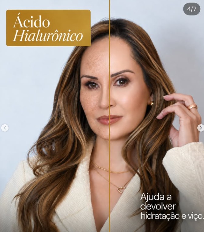 Ácido Hialurônico