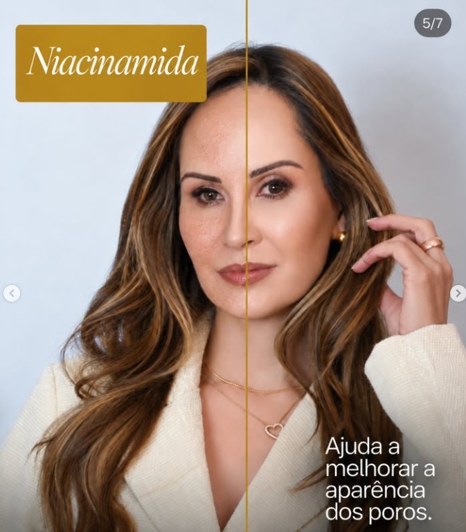 Niacinamida