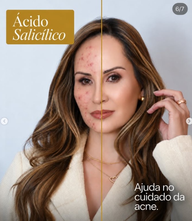 Ácido Salicílico